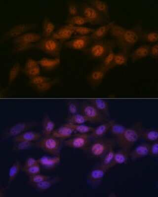 Immunocytochemistry/ Immunofluorescence: WAPL Antibody (3Q4G1) [NBP3-16613]