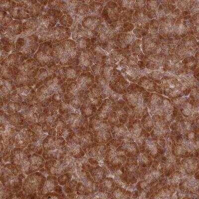 Immunohistochemistry-Paraffin: WAPL Antibody [NBP1-92578]