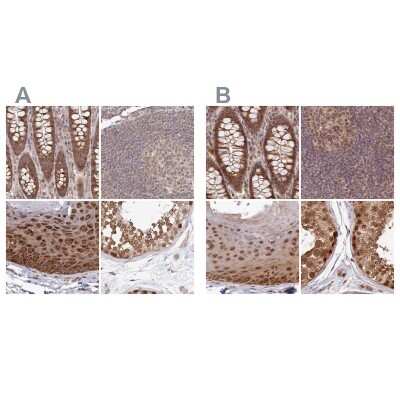 Immunohistochemistry-Paraffin: WAPL Antibody [NBP1-92578]