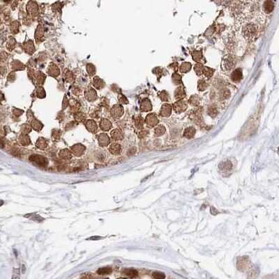 Immunohistochemistry-Paraffin: WAPL Antibody [NBP1-92578]