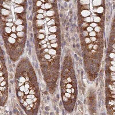 Immunohistochemistry-Paraffin: WAPL Antibody [NBP1-92578]