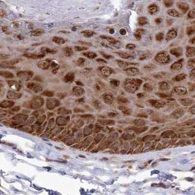 Immunohistochemistry-Paraffin: WAPL Antibody [NBP1-92578]