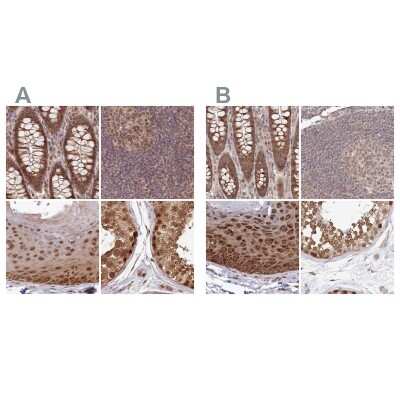 Immunohistochemistry-Paraffin: WAPL Antibody [NBP1-92579]