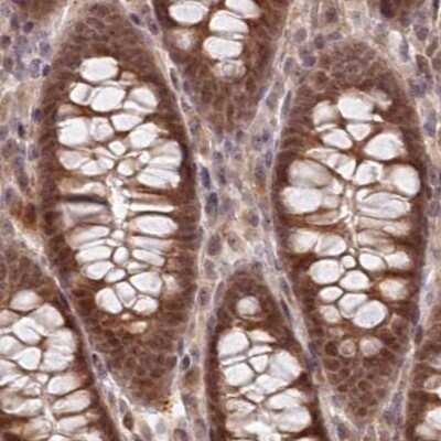 Immunohistochemistry-Paraffin: WAPL Antibody [NBP1-92579]