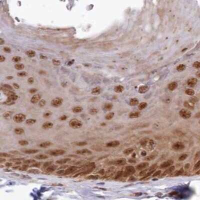 Immunohistochemistry-Paraffin: WAPL Antibody [NBP1-92579]
