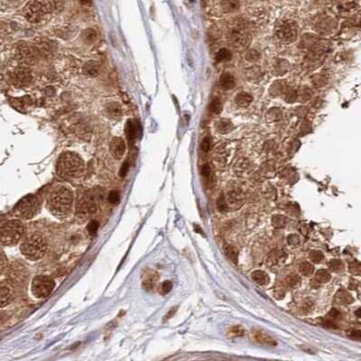 Immunohistochemistry-Paraffin: WAPL Antibody [NBP1-92579]