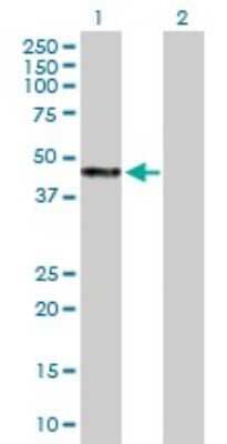 Western Blot: WAPL Antibody [H00023063-B01P]