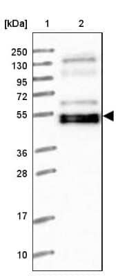 Western Blot: WAPL Antibody [NBP1-92579]