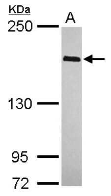 Western Blot: WAPL Antibody [NBP2-20884]