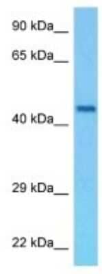 Western Blot: WARP/VWA1 Antibody [NBP3-10148]