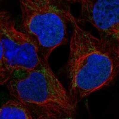 Immunocytochemistry/ Immunofluorescence: WARS2 Antibody [NBP3-17325]