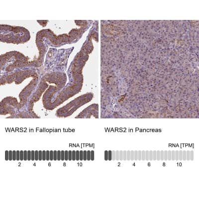 Immunohistochemistry-Paraffin: WARS2 Antibody [NBP2-57679]