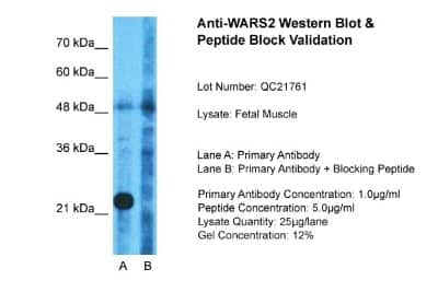 Western Blot: WARS2 Antibody [NBP1-54653]