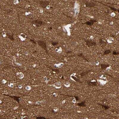 Immunohistochemistry: WASF1/WAVE1 Antibody [NBP1-83018]