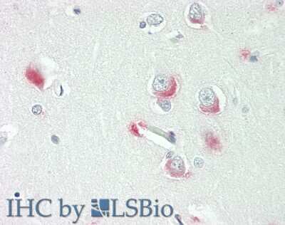 Immunohistochemistry-Paraffin: WASF1/WAVE1 Antibody [NBP2-88584]