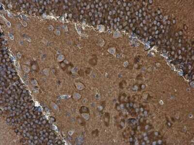 Immunohistochemistry-Paraffin: WASF1/WAVE1 Antibody [NBP3-13180]