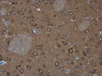 Immunohistochemistry-Paraffin: WASF1/WAVE1 Antibody [NBP3-13180]