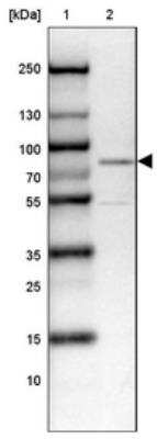 Western Blot: WASF1/WAVE1 Antibody [NBP1-83018]