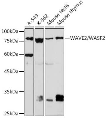 Western Blot: WASF2 Antibody (7A6C10) [NBP3-15806]