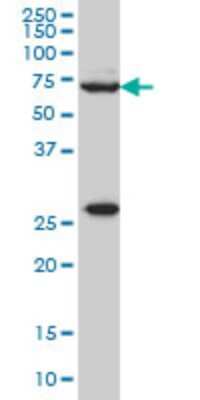 Western Blot: WASF2 Antibody (8E7) [H00010163-M02]