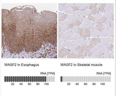 Immunohistochemistry-Paraffin: WASF2 Antibody [NBP2-37912]