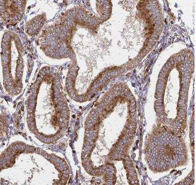 Immunohistochemistry-Paraffin: WASF2 Antibody [NBP2-37912]