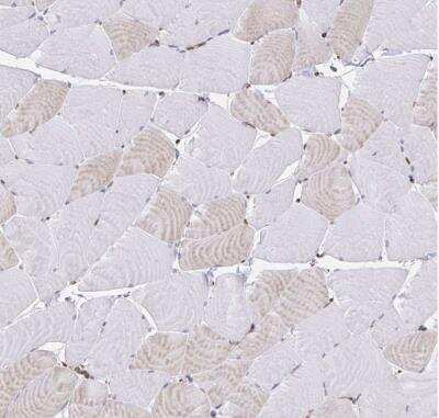 Immunohistochemistry-Paraffin: WASF2 Antibody [NBP2-37912]