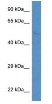 Western Blot: WASF2 Antibody [NBP1-74224]