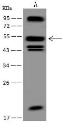 Western Blot: WASF2 Antibody [NBP3-12675]