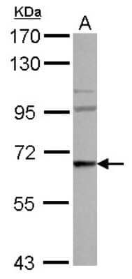 Western Blot: WASF3/WAVE3 Antibody [NBP2-20885]