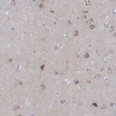 Immunohistochemistry-Paraffin: WASF3/WAVE3 Antibody [NBP3-17779]