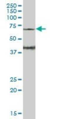 Western Blot: WASF3/WAVE3 Antibody [H00010810-B01P]