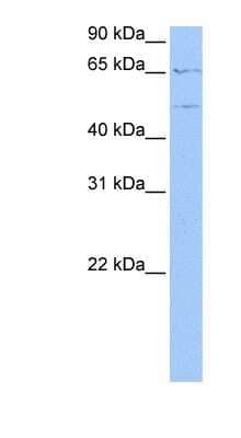 Western Blot: WASF3/WAVE3 Antibody [NBP1-54992]