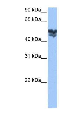 Western Blot: WASF3/WAVE3 Antibody [NBP1-54993]