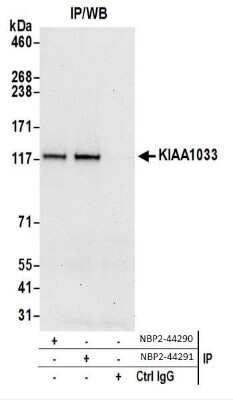 Immunoprecipitation: WASHC4 Antibody [NBP2-44290]