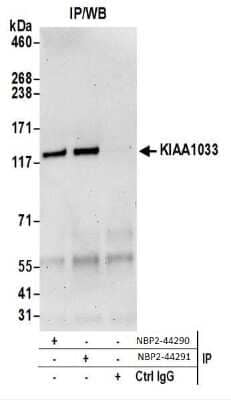 Western Blot: WASHC4 Antibody [NBP2-44291]