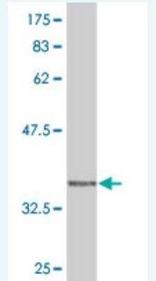 Western Blot: WASP Antibody (3H5) [H00007454-M05]