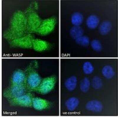 Immunocytochemistry/ Immunofluorescence: WASP Antibody [NB300-996]