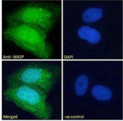 Immunocytochemistry/ Immunofluorescence: WASP Antibody [NB300-996]