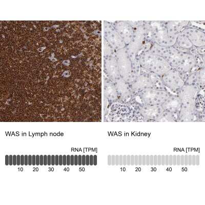 Immunohistochemistry-Paraffin: WASP Antibody [NBP1-87827]