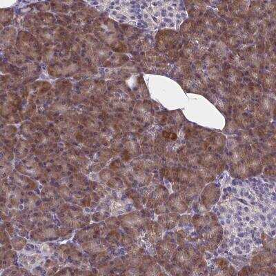 Immunohistochemistry-Paraffin: WBP1 Antibody [NBP2-31660]