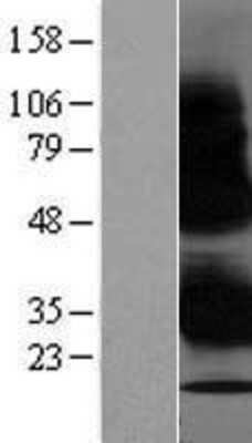 Western Blot: WBP1 Overexpression Lysate [NBP2-07437]