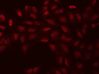 Immunocytochemistry/ Immunofluorescence: WBP11 Antibody [NBP2-97493]