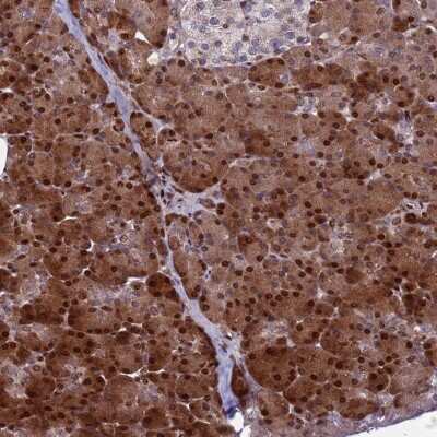 Immunohistochemistry: WBP11 Antibody [NBP2-38551]