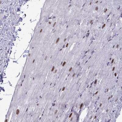Immunohistochemistry: WBP11 Antibody [NBP2-38602]