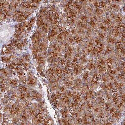 Immunohistochemistry-Paraffin: WBP11 Antibody [NBP1-80988]