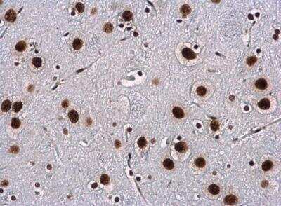 Immunohistochemistry-Paraffin: WBP11 Antibody [NBP2-20886]