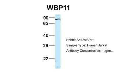 Western Blot: WBP11 Antibody [NBP1-54648]