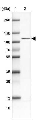 Western Blot: WBP11 Antibody [NBP2-38551]