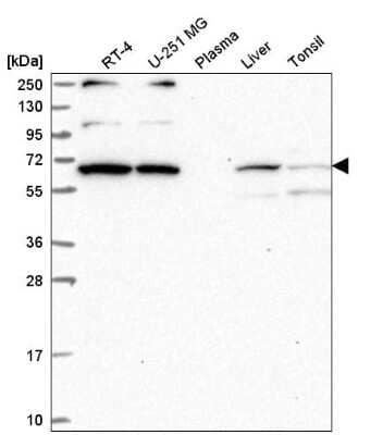 Western Blot: WBP11 Antibody [NBP2-58142]